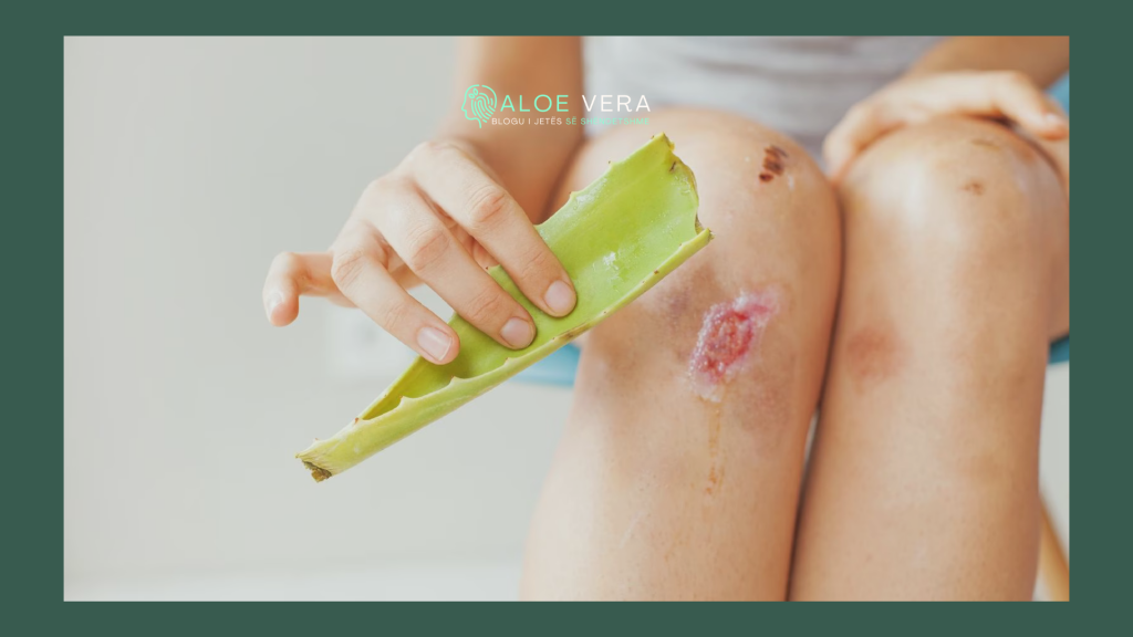 aloe vera për trajtimin të lëkurës dhe plagëve