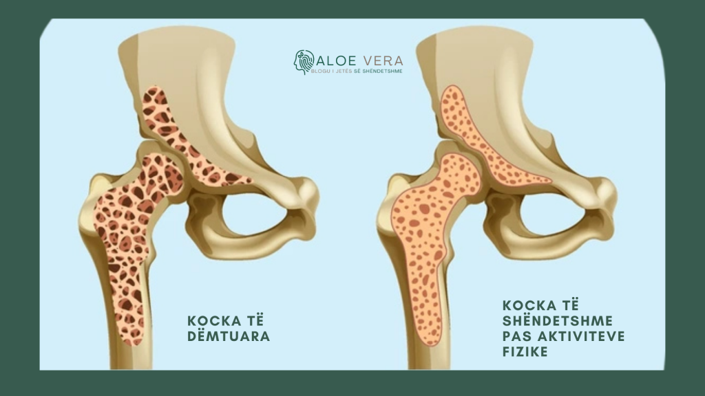ushtrime për forcimin e kockave